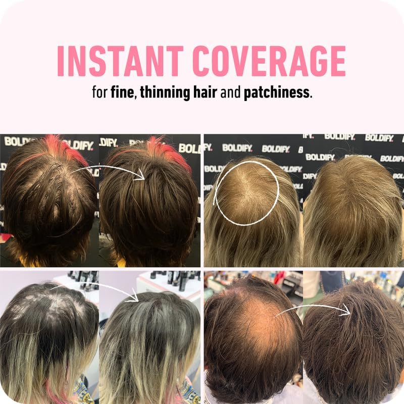 BOLDIFY Hair Fibers (56g) - Fill In Thinning and Fine Hair for an Instantly Fuller, Thicker Look - 14 Shades for Women & Men - Color: Select on Amazon.