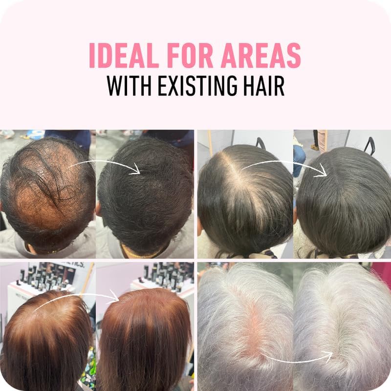 BOLDIFY Hair Fibers (56g) - Fill In Thinning and Fine Hair for an Instantly Fuller, Thicker Look - 14 Shades for Women & Men - Color: Select on Amazon.